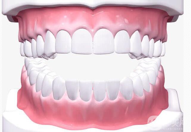 噴砂洗牙原理是怎樣的呢 *果好不好？