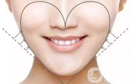 面部吸脂*果圖 面部吸脂注意事項