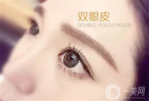 北京雙眼皮手術(shù)價(jià)格 雙眼皮手術(shù)多久消腫
