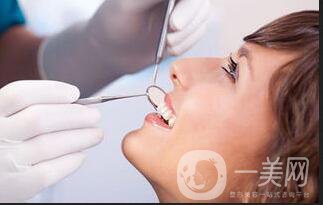 光固化樹脂補(bǔ)牙價(jià)格