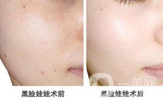 黑臉娃娃多少錢