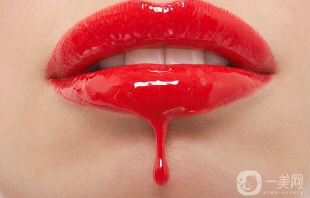 玻尿酸豐唇珠后需注意什么 該如何護(hù)理？