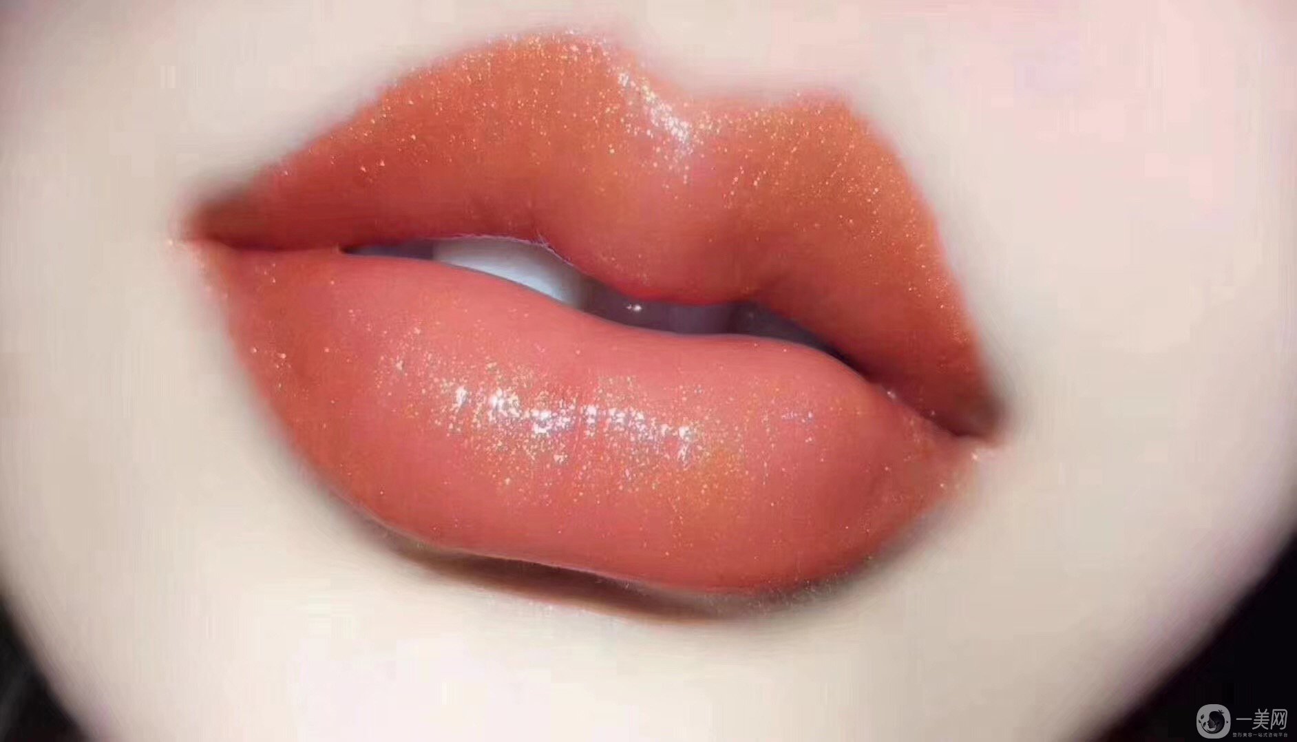 玻尿酸豐唇要幾支 普通女孩子負(fù)擔(dān)得起嗎？