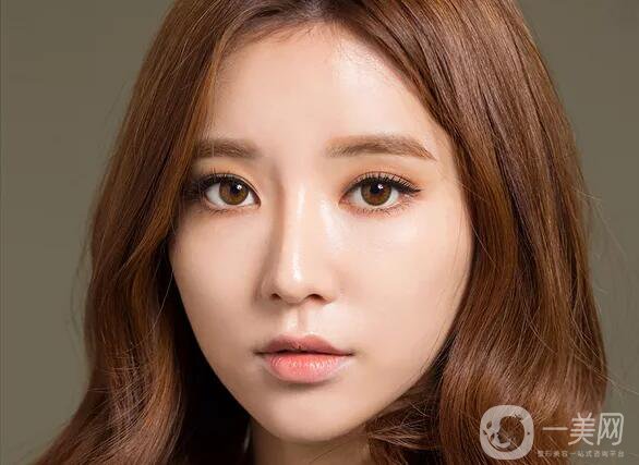 顴骨內推貴嗎 顴骨內推*果好不好