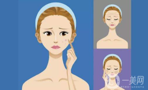 什么叫光子嫩膚 光子嫩膚能維持多久