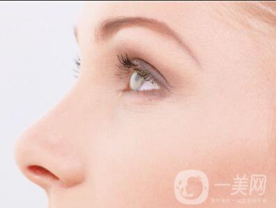 做個(gè)鼻翼縮一次多少錢(qián)