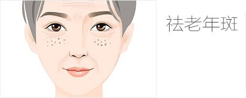 老年斑是怎樣形成的 怎樣能去掉?