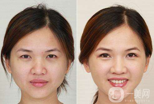 打*的*果好不好 打*有危害嗎