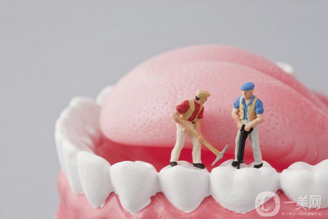 一個烤瓷牙多少錢 價格和哪些因素相關(guān)？