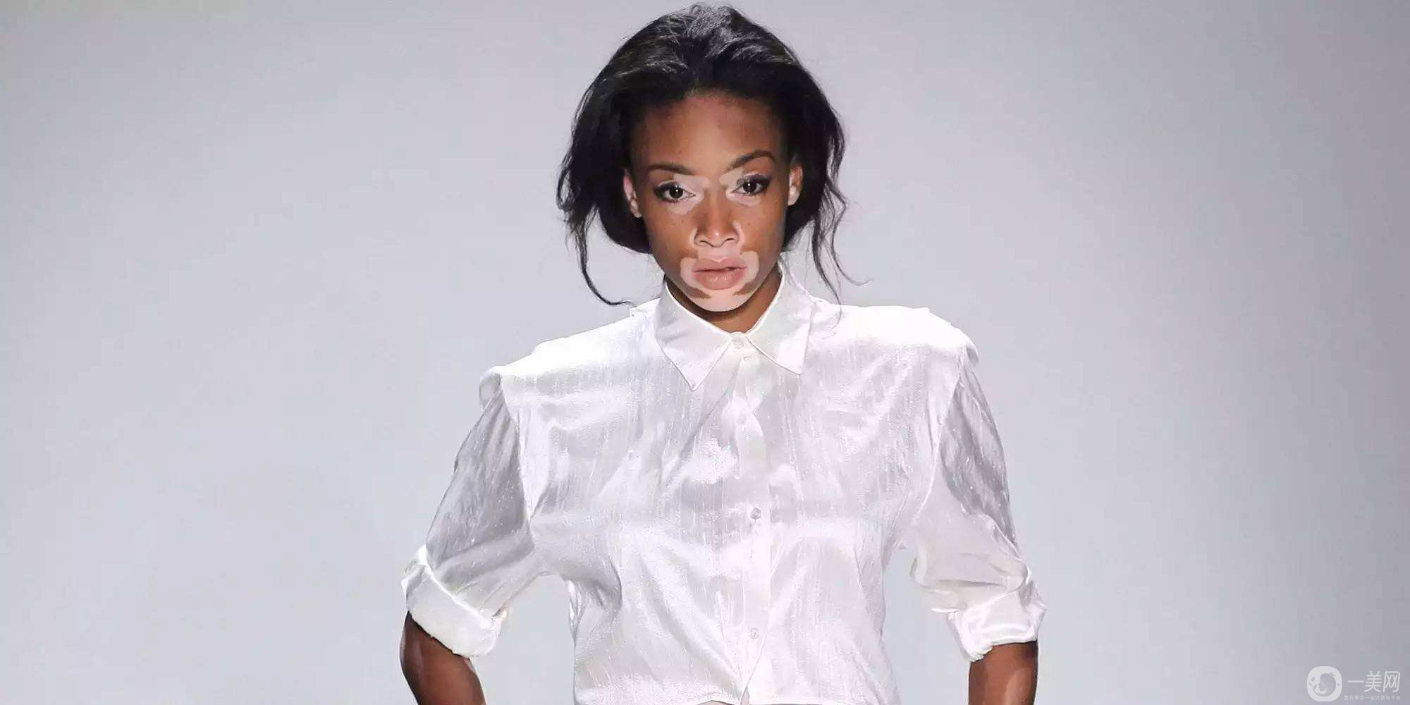 出現(xiàn)白斑該如何處理呢？