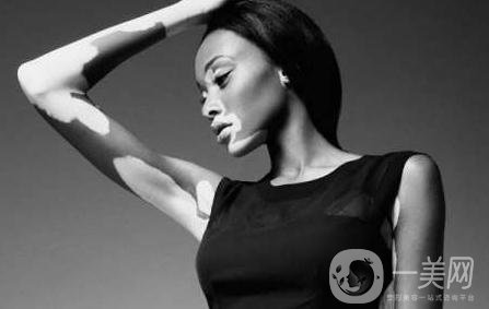 出現(xiàn)白斑該如何處理呢？