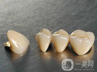 純鈦烤瓷牙價格 純鈦烤瓷牙的壽命*嗎