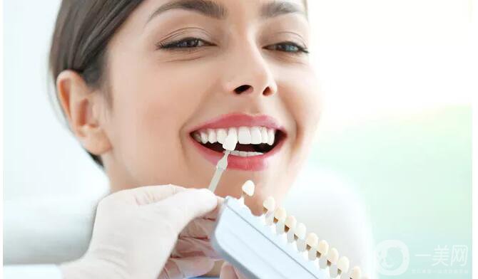 美容冠修復多少錢 美容冠修復*果怎么樣