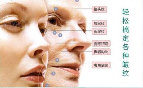 整容手術要多久時間 整容手術風險有多大