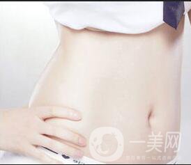 腹壁成形術(shù)風險,腹壁成形術(shù)注意事項