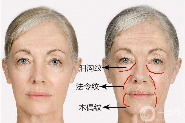 雕塑美學(xué)能治什么 雕塑美學(xué)調(diào)節(jié)時(shí)間