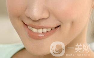 人造酒窩前后照片,人造酒窩多少錢(qián)