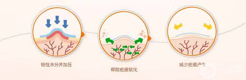 祛疤手術(shù)好還是激光好 恢復(fù)時(shí)間分別是多久