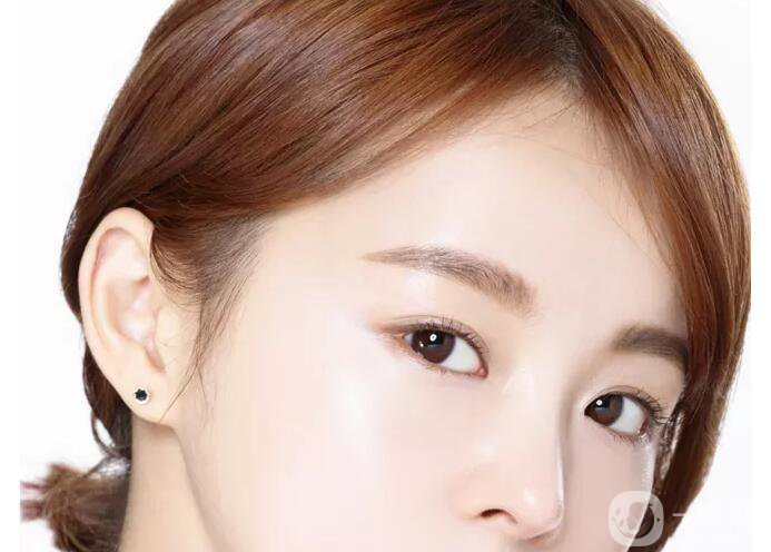 韓式半*發(fā)際線危害 發(fā)際線術(shù)后注意事項(xiàng)