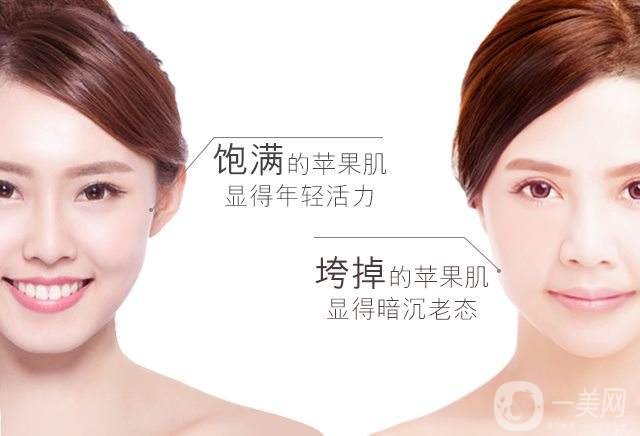 打了蘋(píng)果肌硬塊多久消 術(shù)后需要注意什么