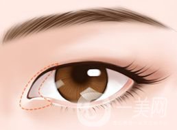 開眼角的*果怎么樣 好不好？