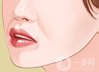 自體脂肪填充鼻唇溝怎么樣 能保持多久？