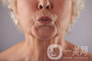 出現(xiàn)煙民線該如何調(diào)節(jié)呢？