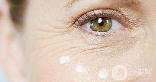 眼角除皺手術(shù)多少錢 眼角除皺的方法