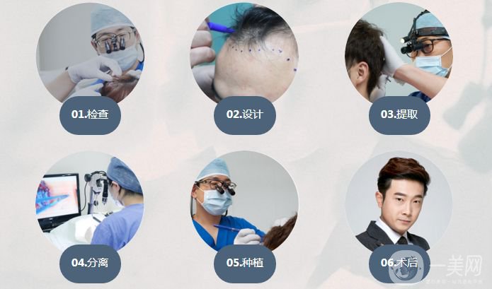 怎樣調(diào)節(jié)脫發(fā) 脫發(fā)的原因是什么