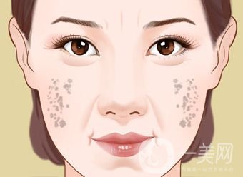 怎樣治老年斑 調(diào)節(jié)方法有哪些？