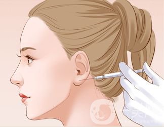 玻尿酸注射豐耳垂價格一般是多少?