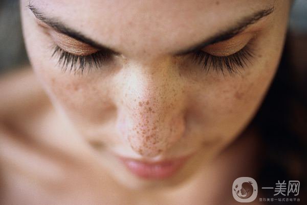 磁光祛斑多少錢(qián)一次？會(huì)反彈嗎？