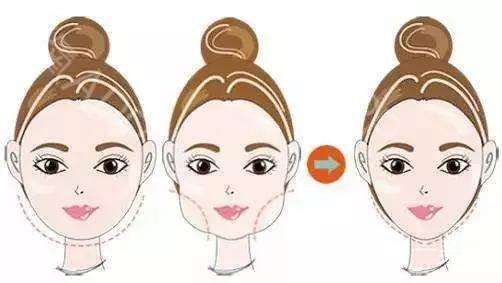 臉部光纖溶脂價(jià)格 臉部光纖溶脂的作用