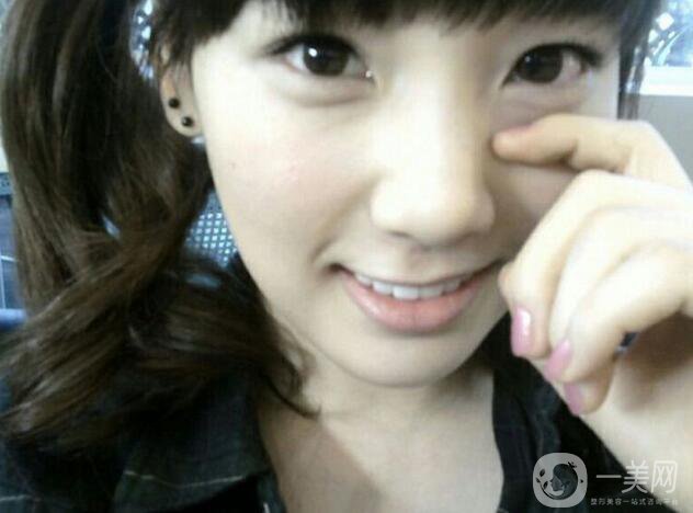 金泰妍整容了嗎?金泰妍整容變臉史詳細(xì)扒皮貼