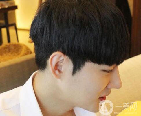 男人隆鼻前后附照片 隆鼻*果好嗎？