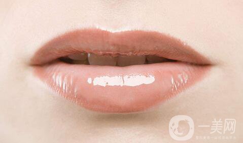 玻尿酸豐唇怎么樣？