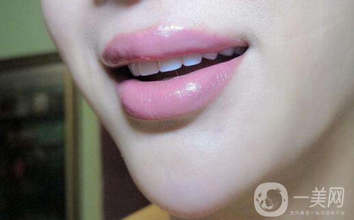 玻尿酸豐唇怎么樣？