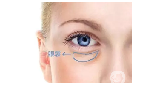 去眼袋手術費用是多少錢 *果*嗎