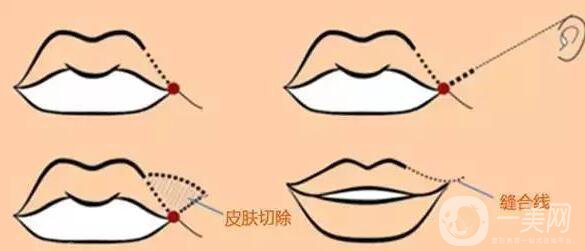 標(biāo)準(zhǔn)的仰月唇女明星有哪些？其中還有AB的整容模板！