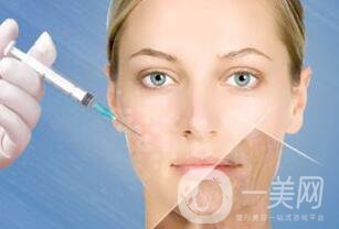 *除皺價(jià)格,*除皺費(fèi)用