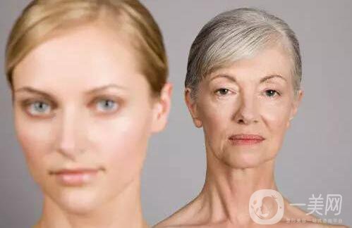 拉皮手術照片,拉皮手術后遺癥