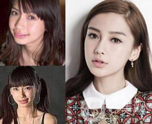 有沒有可能Angelababy不做整容手術(shù)就改變了這么多？