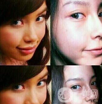 有沒有可能Angelababy不做整容手術(shù)就改變了這么多？