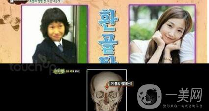 樸智英整形CT掃描曝光 我們可以從中學(xué)到什么