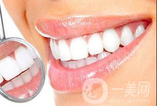 上海洗牙多少錢