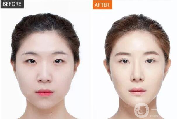 **多久見(jiàn)*,***果保持多久