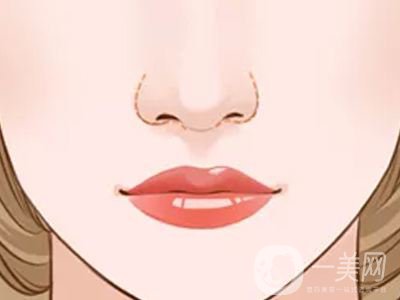鼻翼縮窄手術(shù)后遺癥有哪些