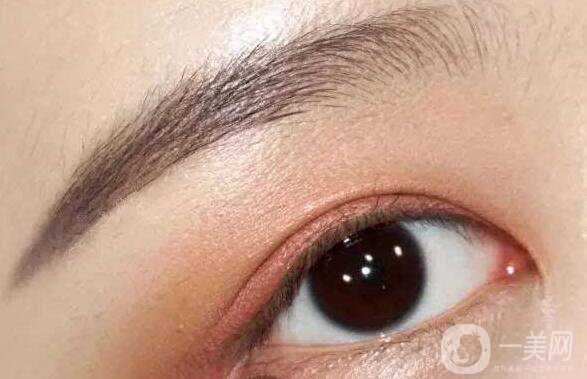 上眼皮吸脂價格,雙眼皮