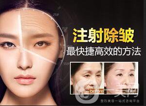 去除抬頭紋風(fēng)險(xiǎn),去除抬頭紋方法