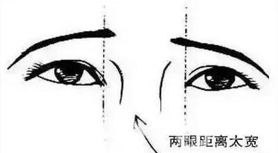 開(kāi)眼角疼嗎？這幾種情況開(kāi)眼角*果堪比換頭！